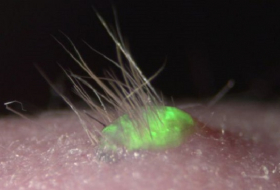 Promising lab-grown skin sprouts hair and grows glands